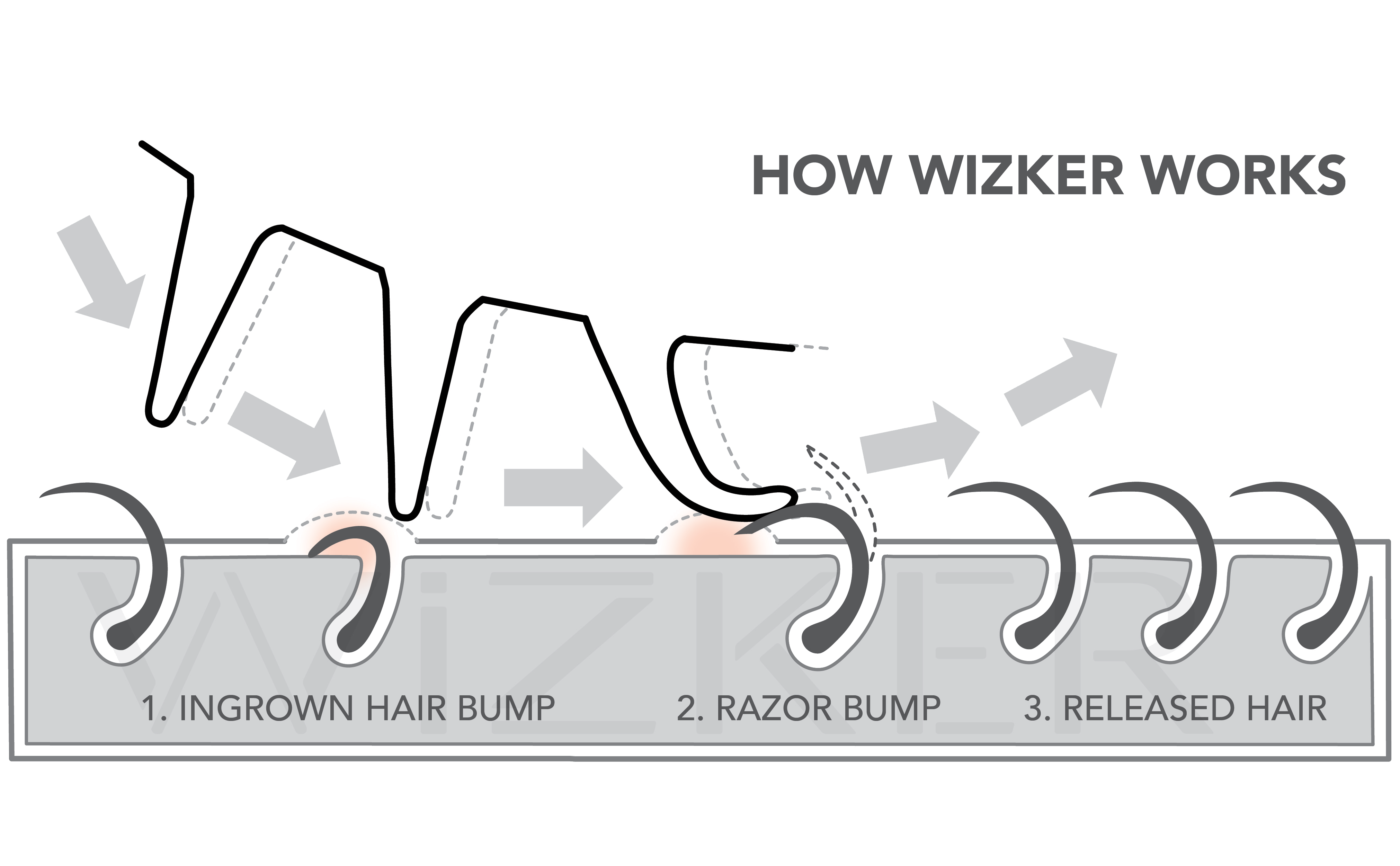 How Wizker Works