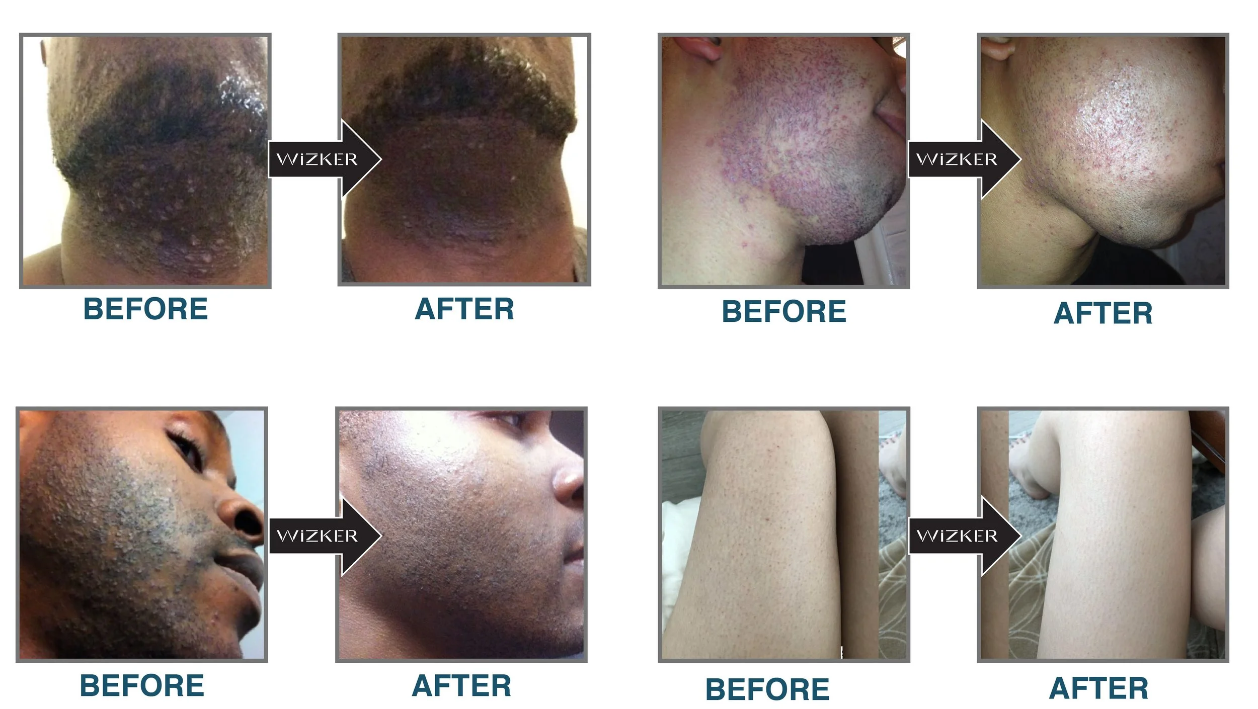 Before and After Wizker results
